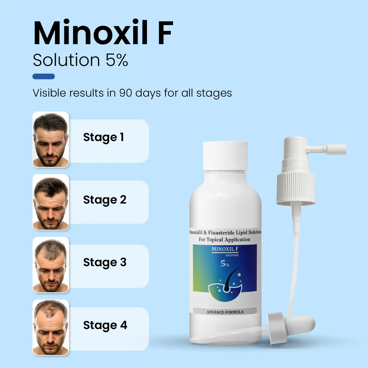 Minoxil F 5% Topical Solution | For Hair Growth