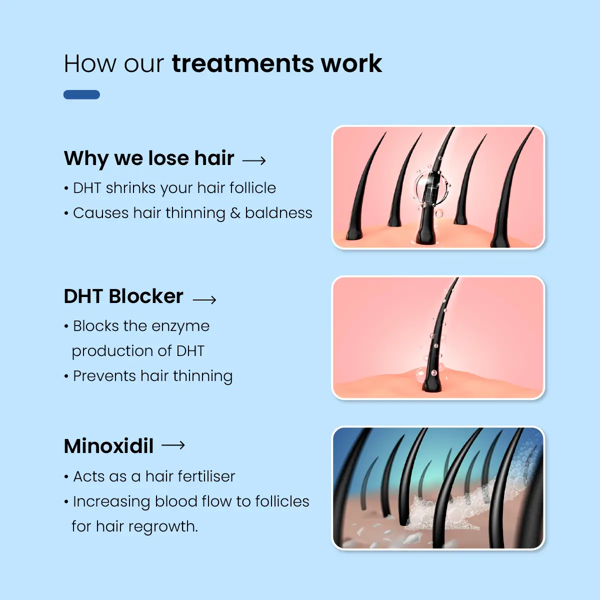 Minoxil F 5% Topical Solution | For Hair Growth