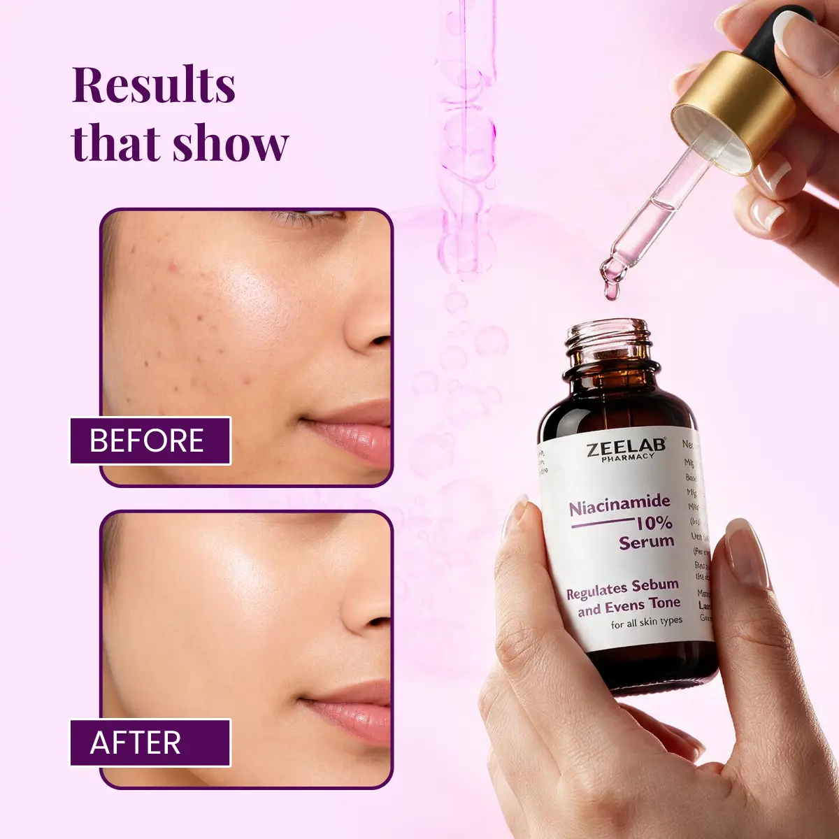 niacinamide-serum-03